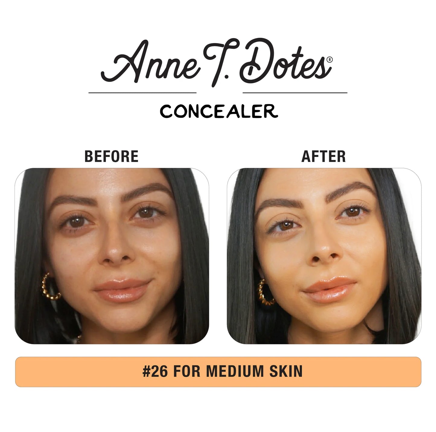 ANNE T. DOTES® CONCEALER - REF 26